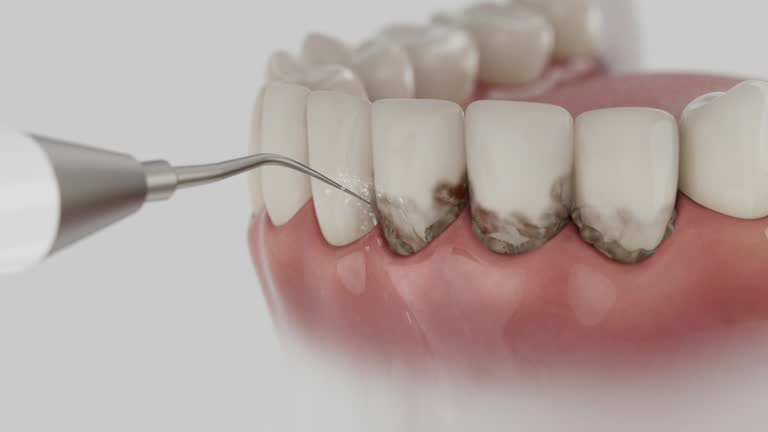 Reliable Root Canal Treatment contractor in Ashe County County, NC by Dentist Open Now